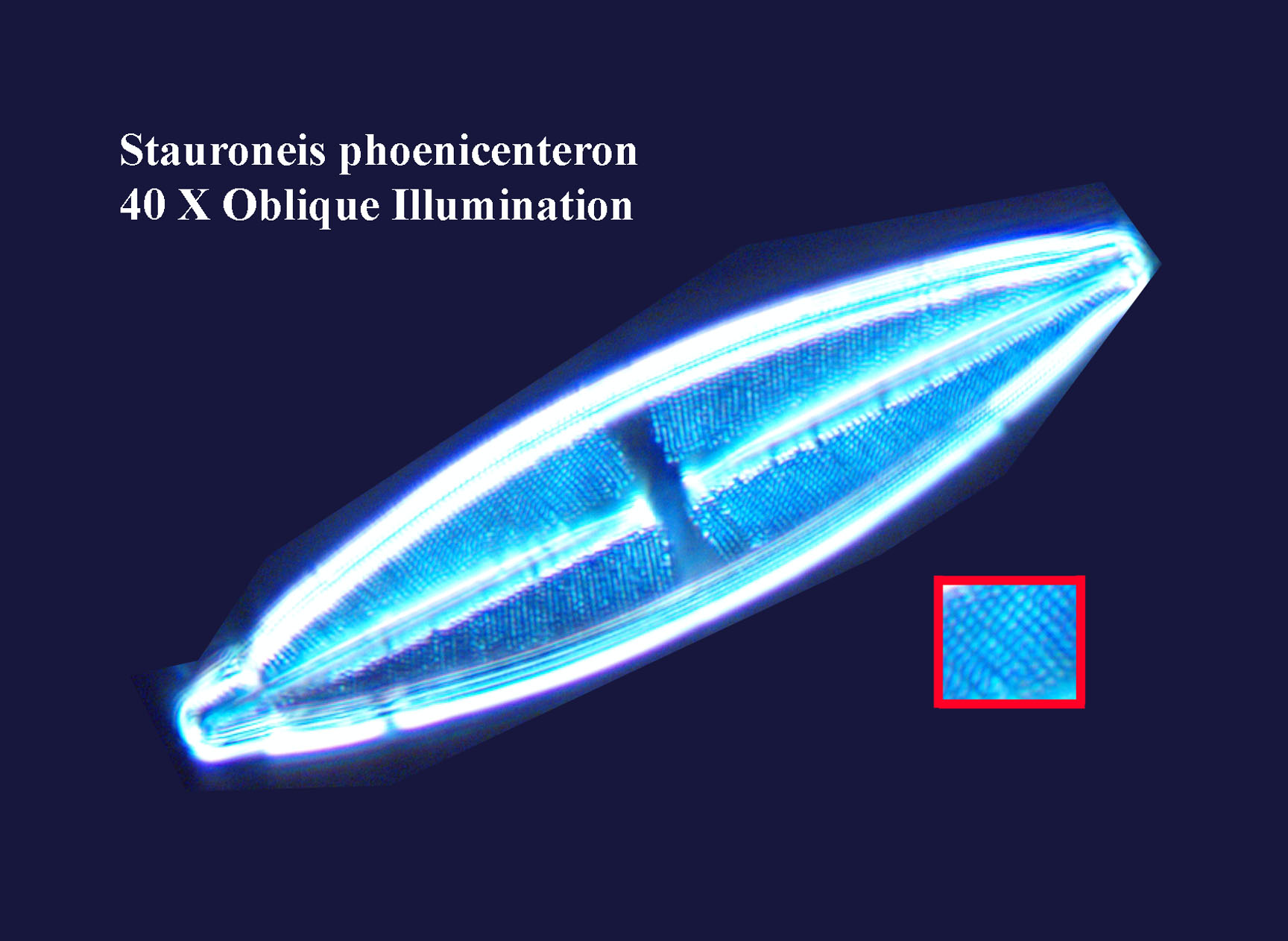 diatom