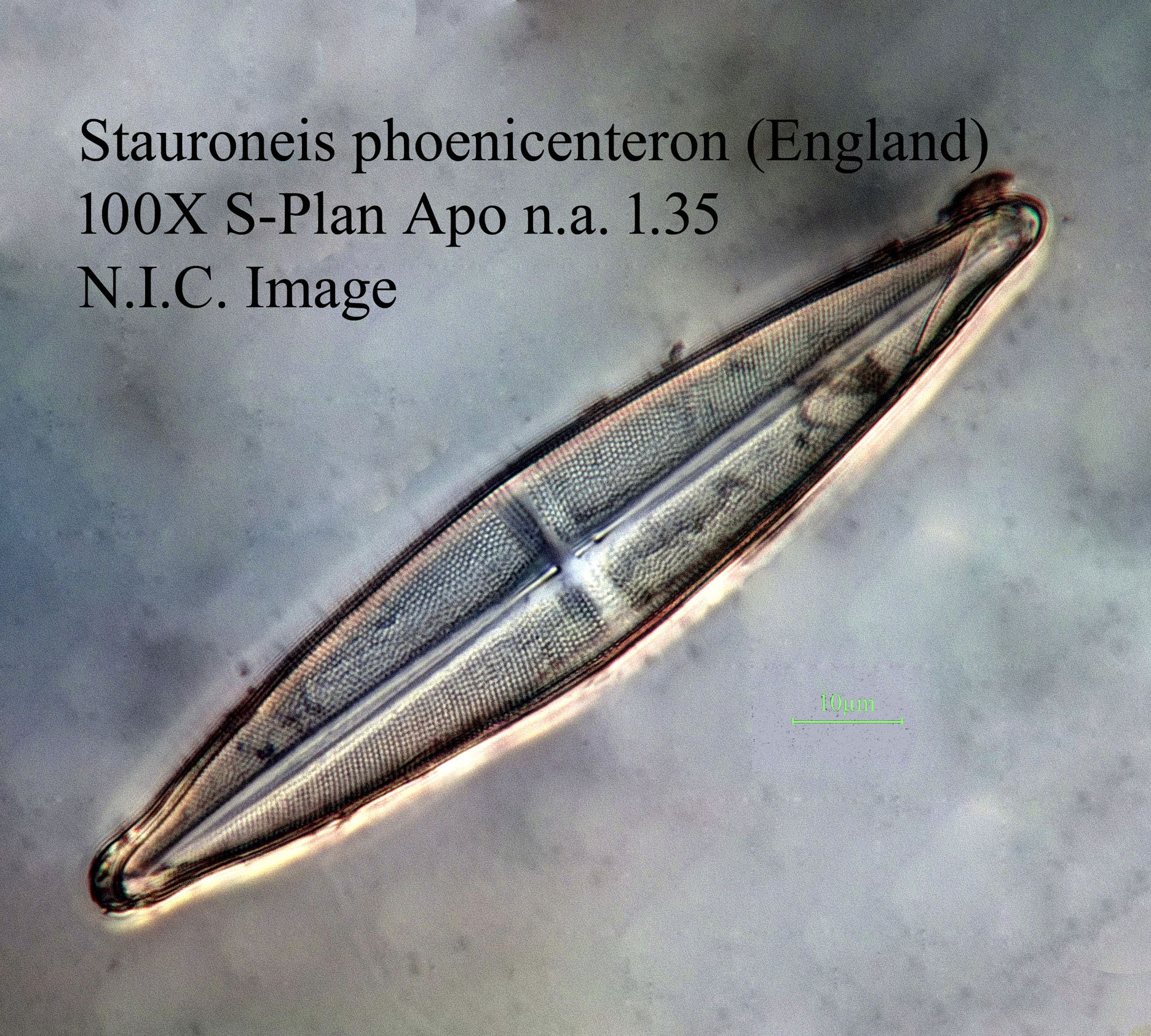 Stauroneis phoenicenteron