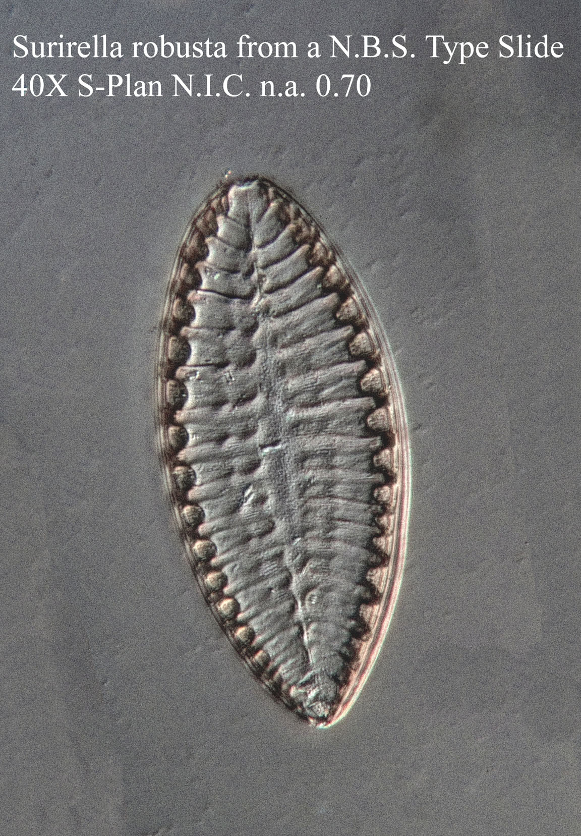 diatom