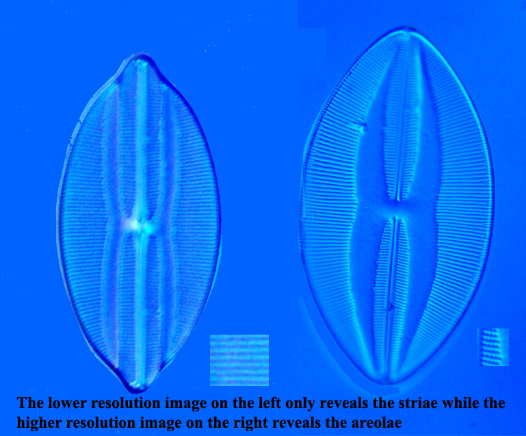 striae vs alveolae