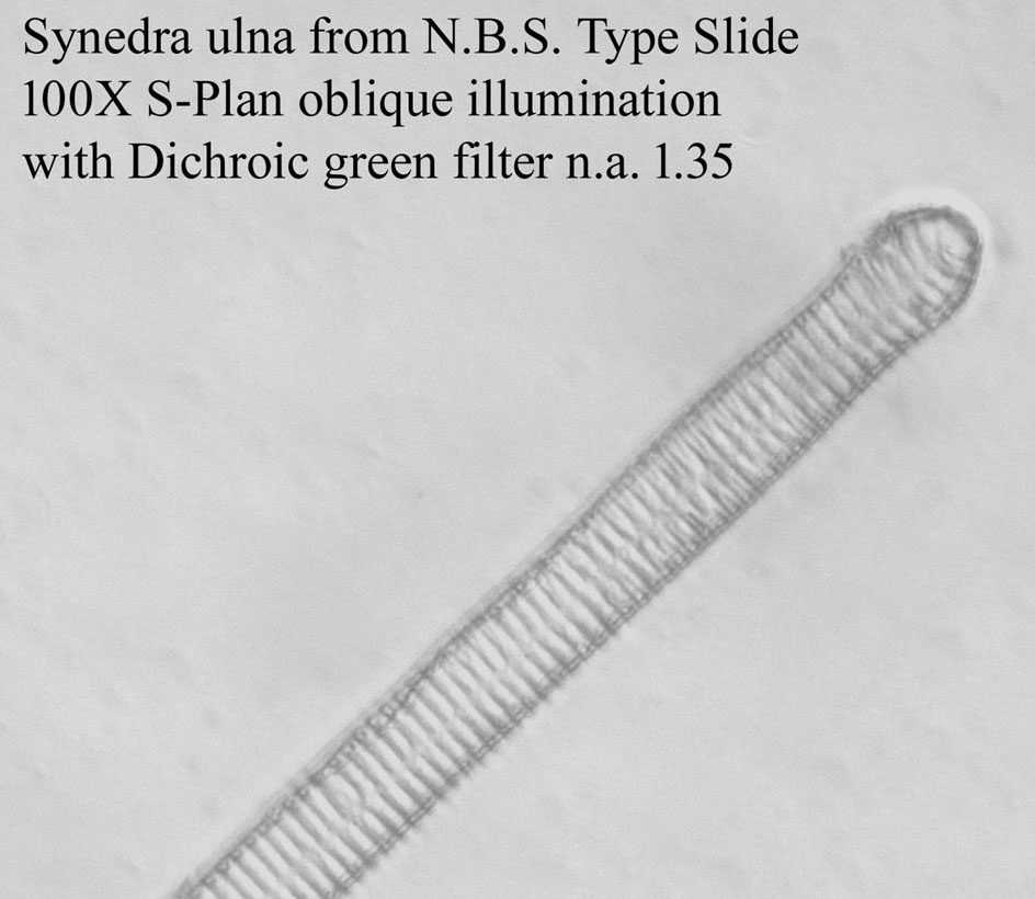 diatom
