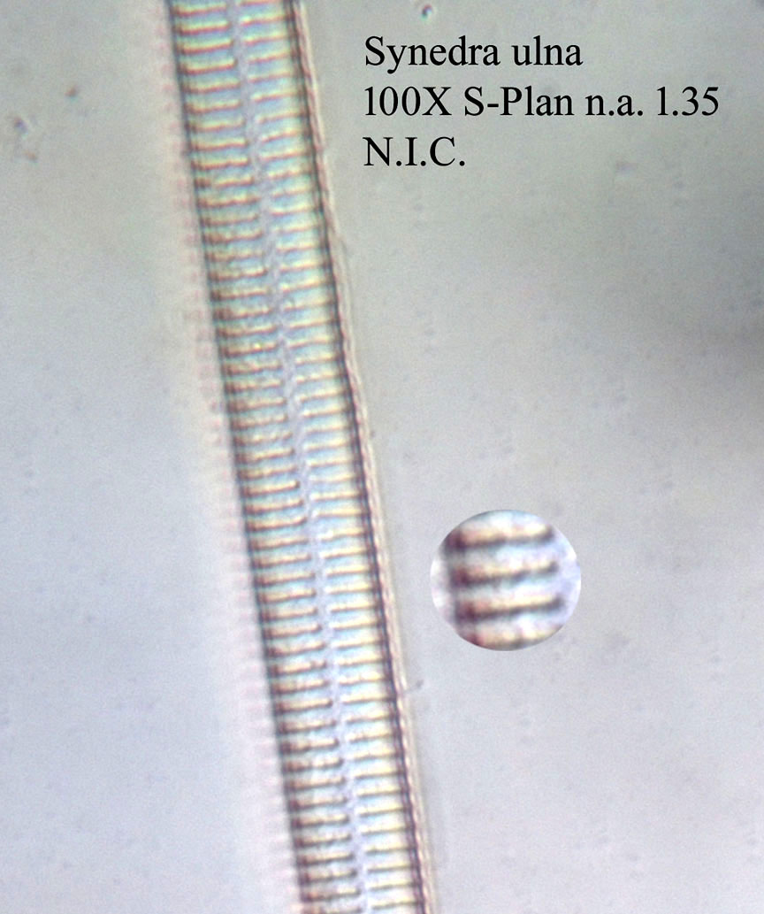 diatom