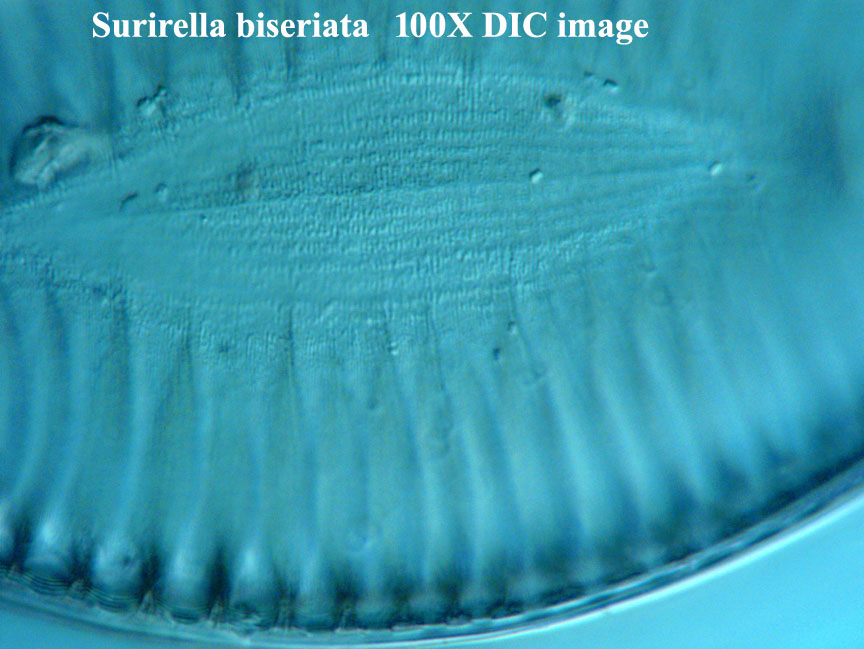 diatom