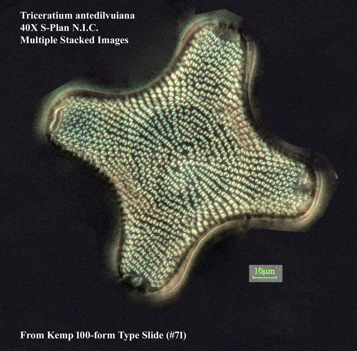 Triceratium antidiluviana