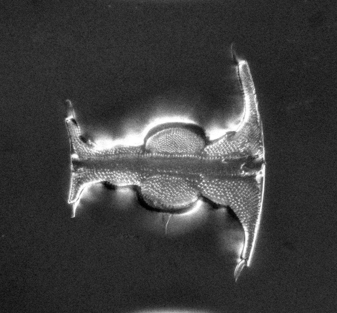 diatom