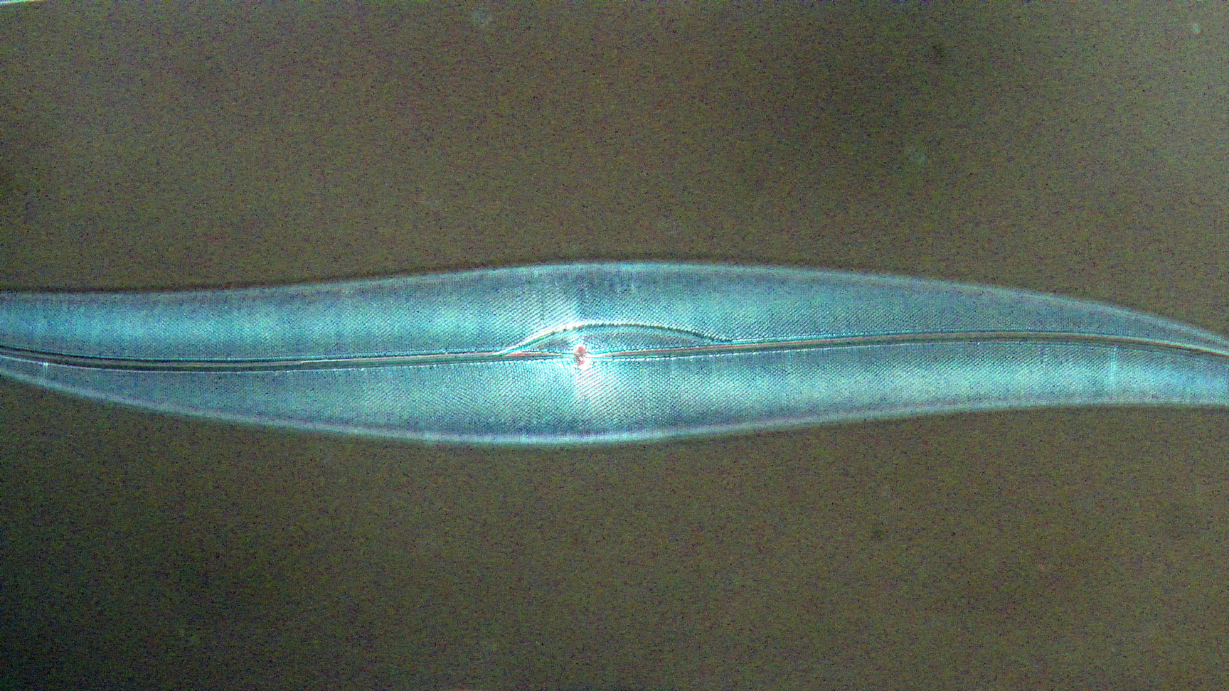 diatom