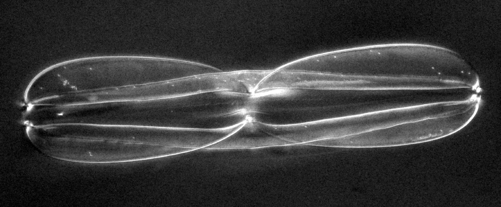 diatom