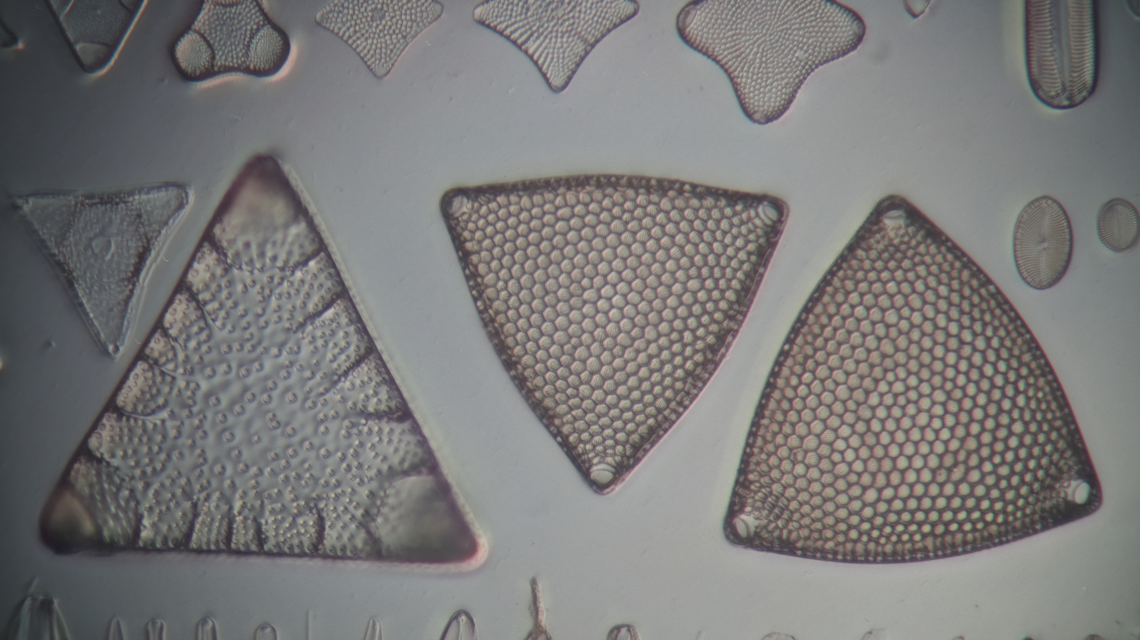 diatom