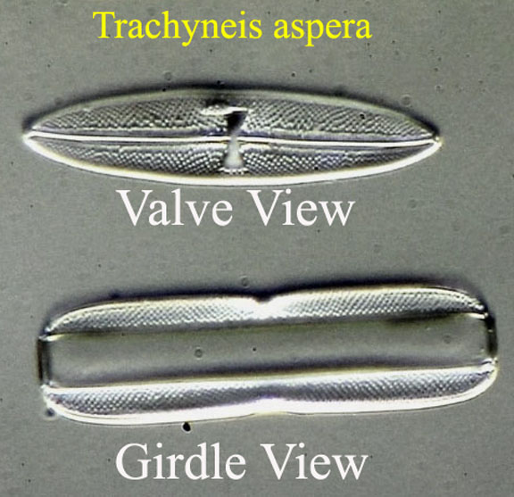 valve and girdle view